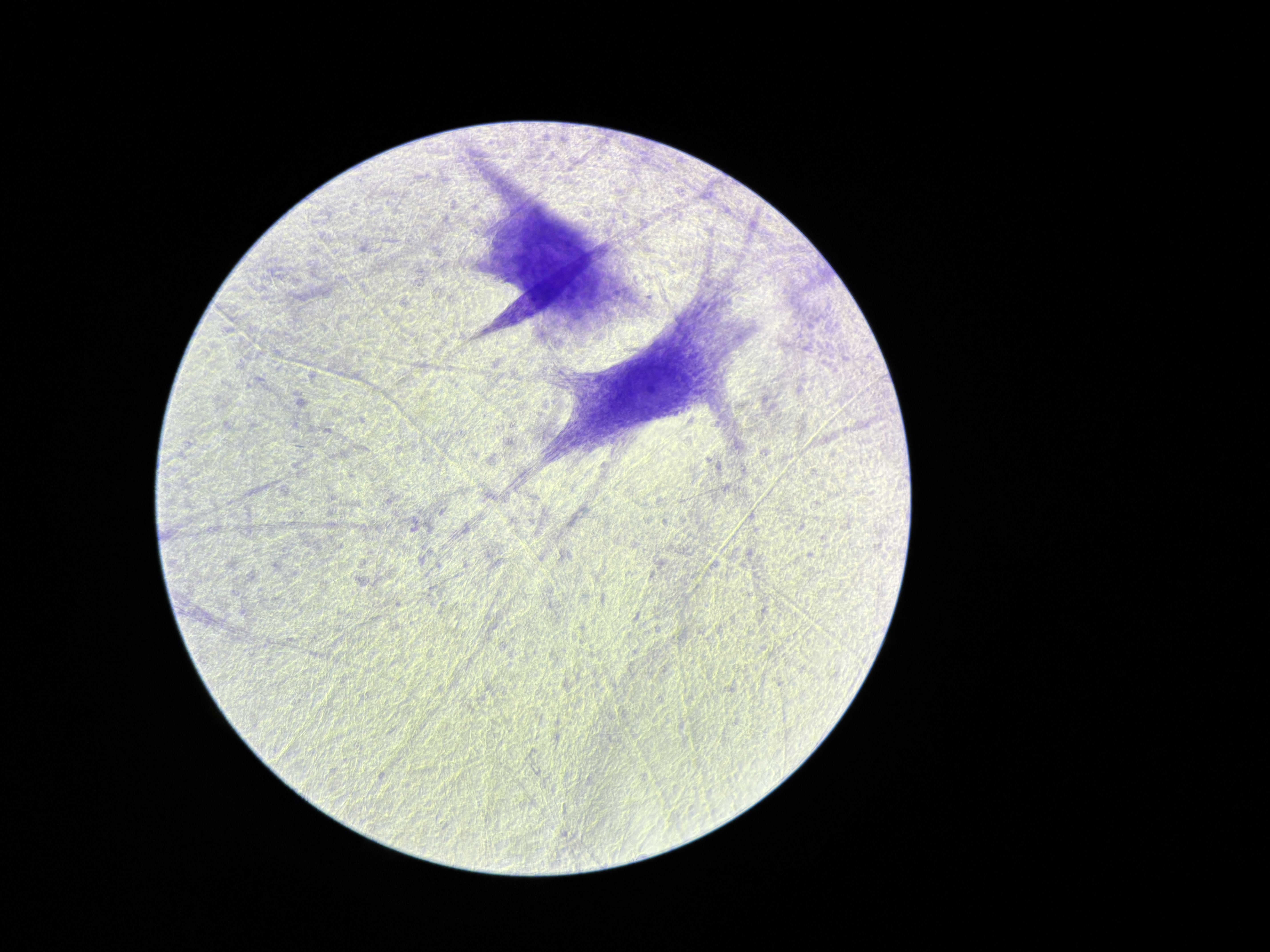Sheep brain dissection
